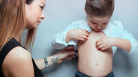 Little boy with measles